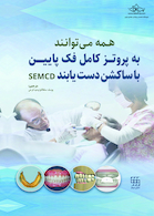 همه می توانند به پروتز کامل فک پایین با ساکشن دست یابند SEMCD